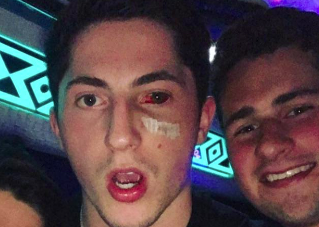 Zach Werenski Eye Injury - Zach Werenski Injury Forces Him To Miss The Remainder Of The Postseason Last Word On Hockey _ The columbus blue jackets rookie defenseman took a puck to the face during the second period of sunday's game 3 as werenski was skating off the ice after getting hit, the penguins were able to score.