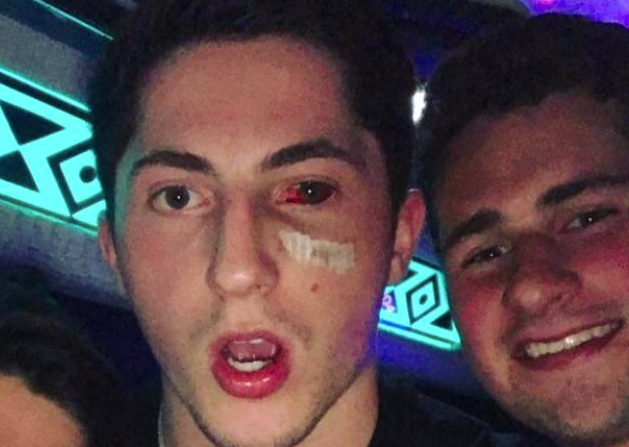 Blue Jackets' Zach Werenski returns to playoff game with black eye