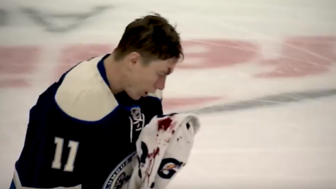 Matt Calvert bleeds from his head as he takes a puck during a game against the New York Rangers